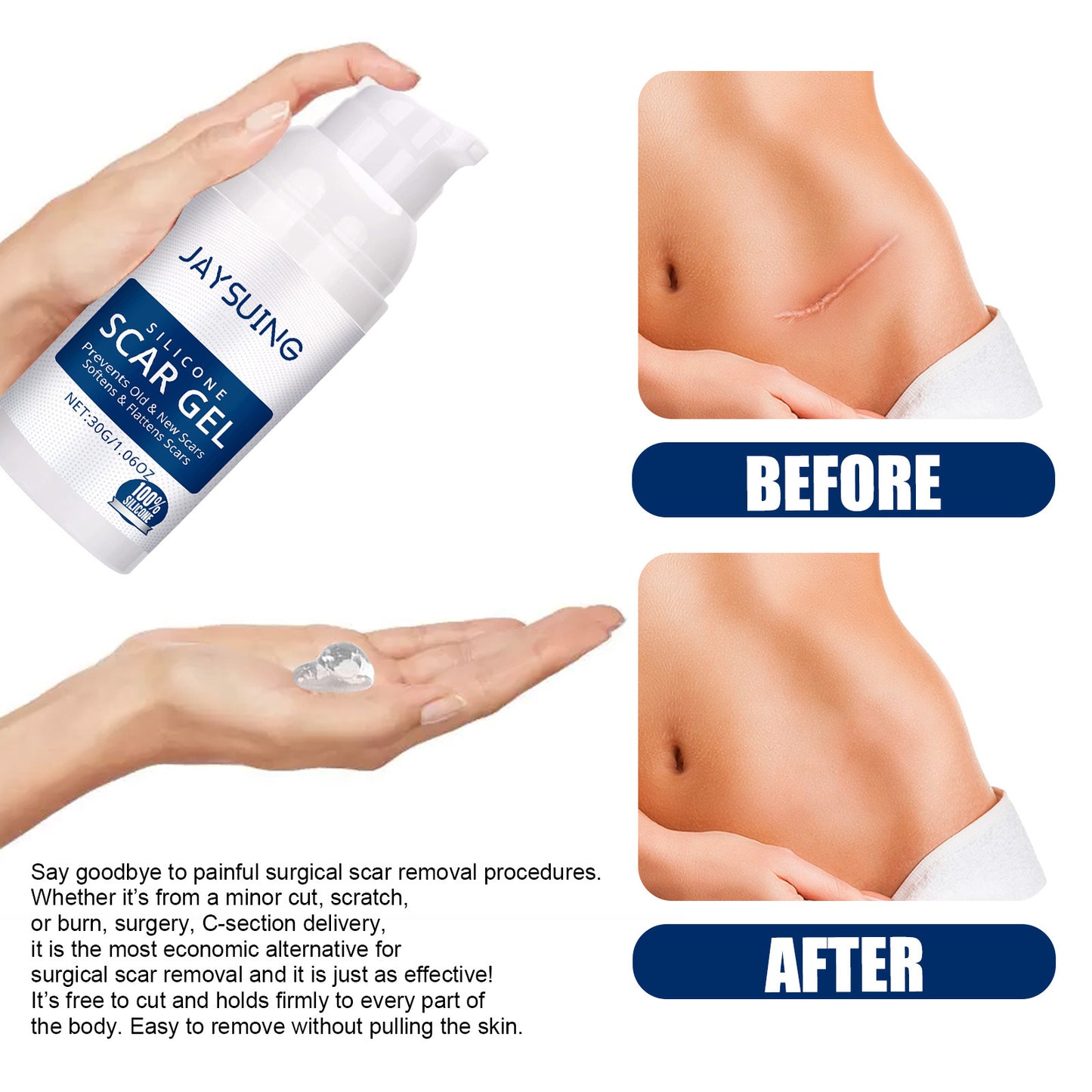 JAYSUING™ Advanced Silicone Skin Renewal Gel