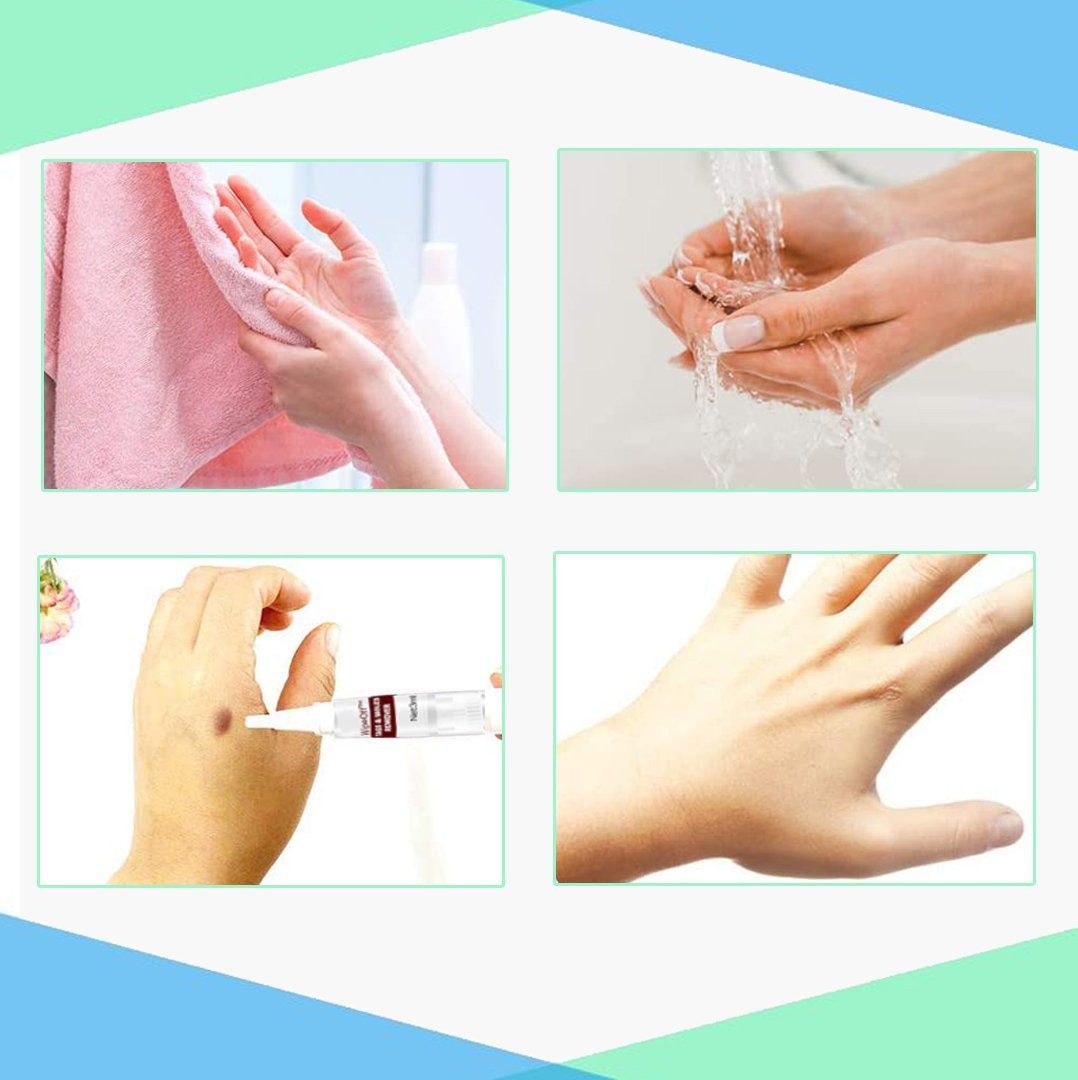 WipeOff  Tags   Moles Remover