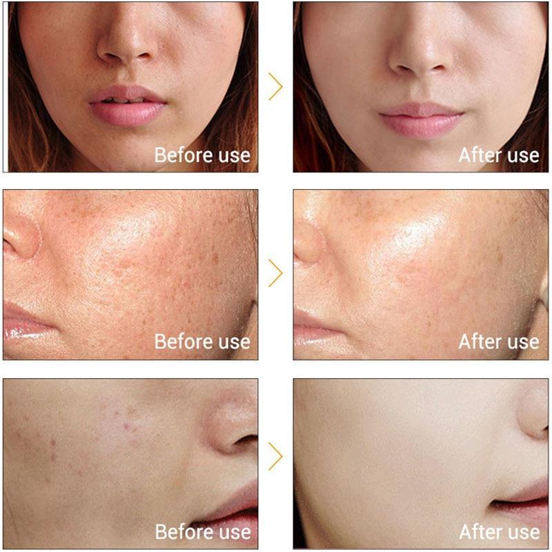Vitamin C Whitening Face Serum