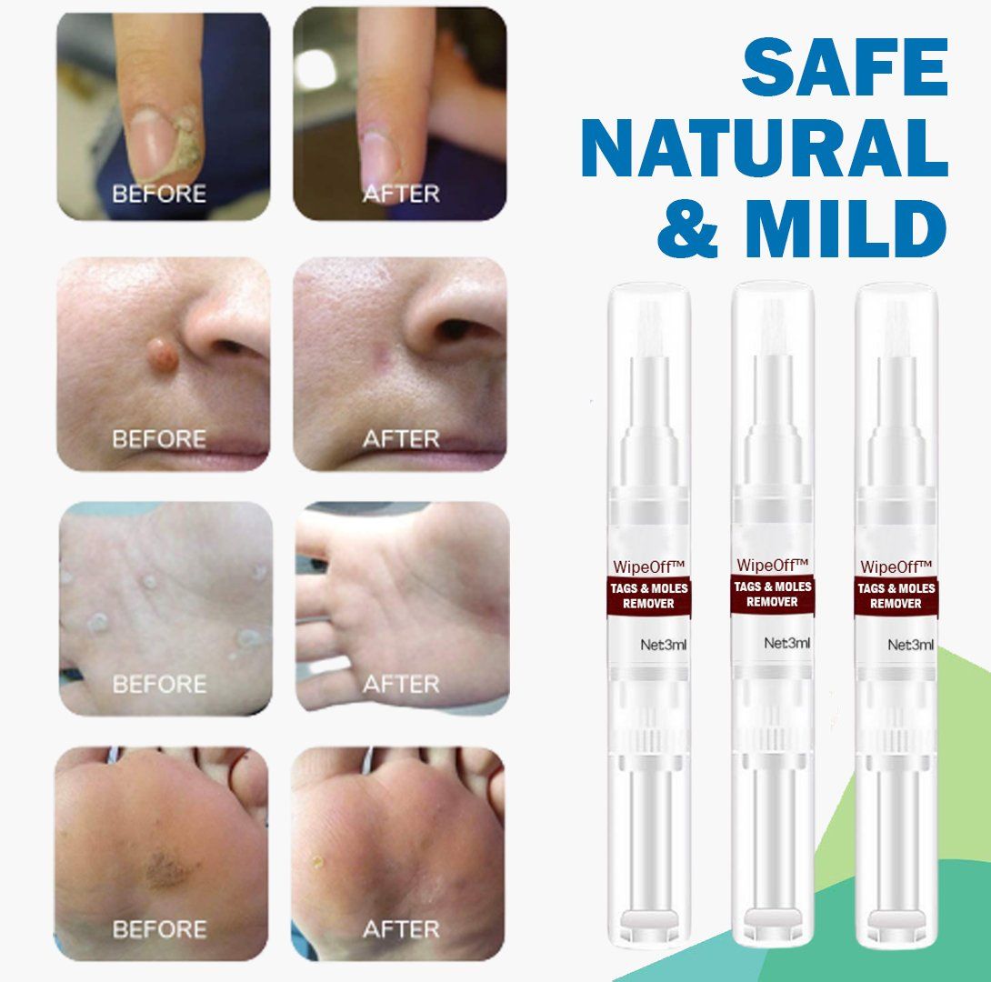 WipeOff  Tags   Moles Remover