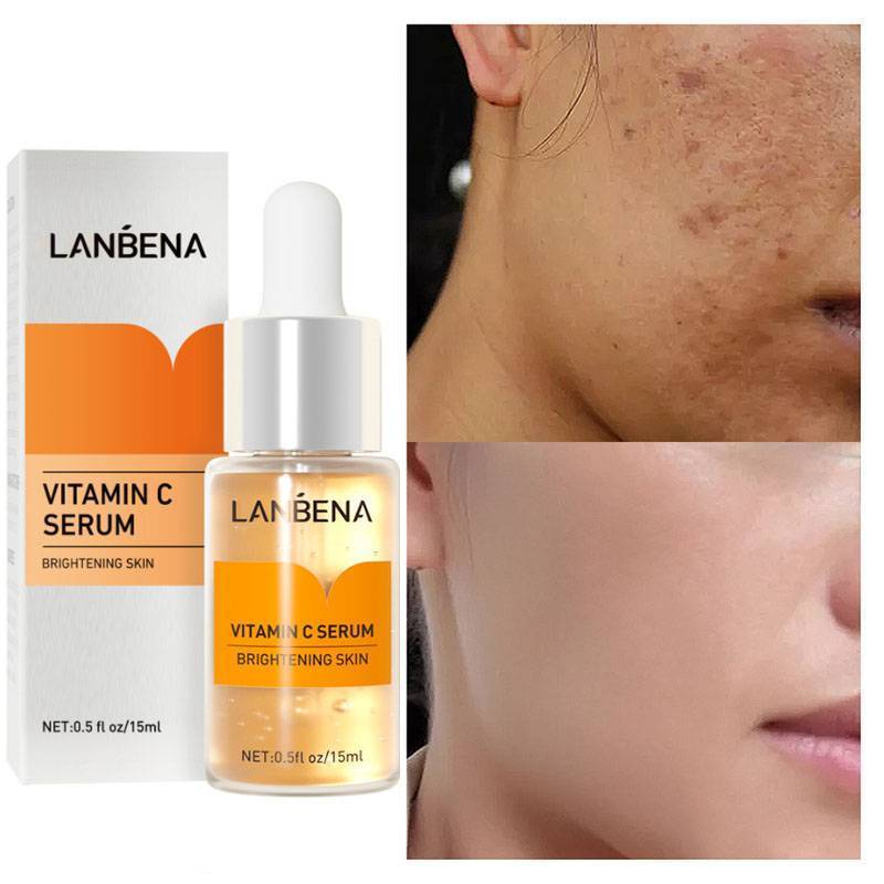 Vitamin C Whitening Face Serum